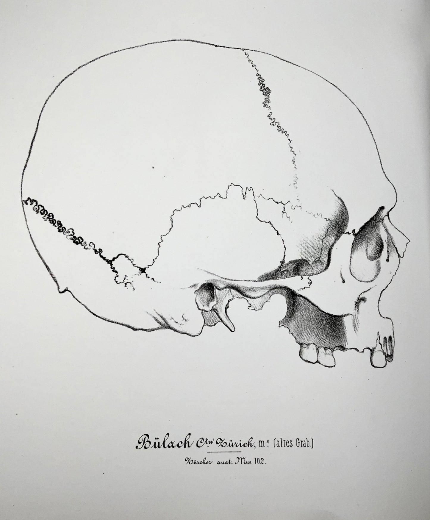 1864 Rutimeyer &amp; His, Crania Helvetica, 82 lithographies sur pierre, édition unique, anatomie, livre
